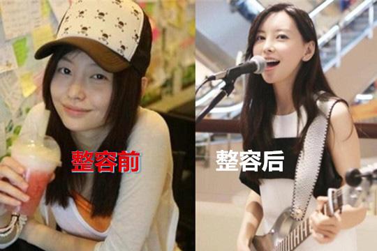 于文文整容，罗米前任3(于文文有没有整容)