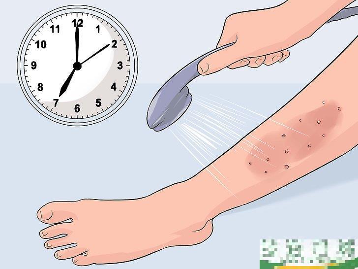 怎么消除使用脱毛膏引起的皮疹(用脱毛膏后皮肤出现脱皮现象怎么办)