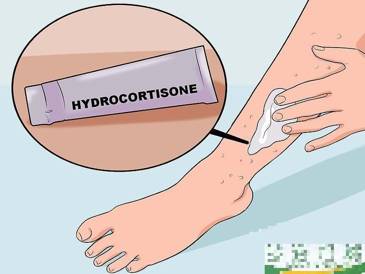 怎么消除使用脱毛膏引起的皮疹(用脱毛膏后皮肤出现脱皮现象怎么办)