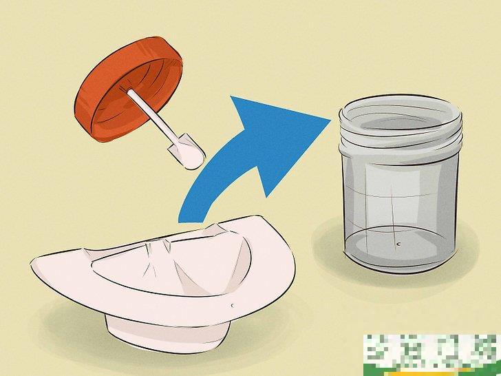 怎么采集粪便样本(粪便标本怎么采集) 怎么采集粪便样本(粪便标本怎么采集)