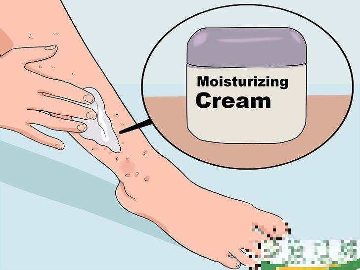 怎么消除使用脱毛膏引起的皮疹(用脱毛膏后皮肤出现脱皮现象怎么办)