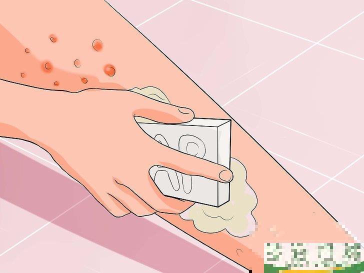 怎么消除使用脱毛膏引起的皮疹(用脱毛膏后皮肤出现脱皮现象怎么办)