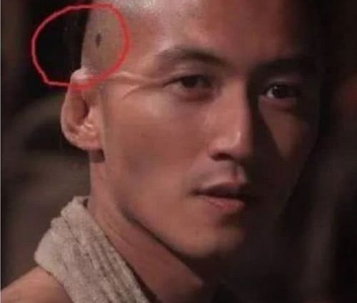 谢霆锋癌症，明星得癌症(得癌症的明星)