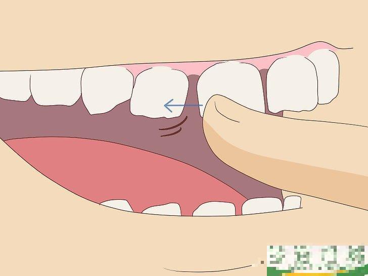 怎么无痛拔牙(怎么无痛拔牙?)