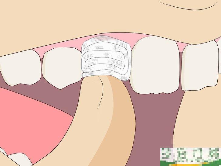 怎么无痛拔牙(怎么无痛拔牙?) 怎么无痛拔牙(怎么无痛拔牙?)