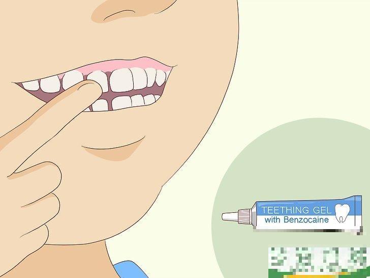 怎么无痛拔牙(怎么无痛拔牙?) 怎么无痛拔牙(怎么无痛拔牙?)