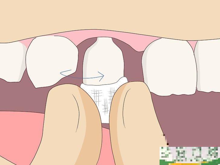 怎么无痛拔牙(怎么无痛拔牙?) 怎么无痛拔牙(怎么无痛拔牙?)