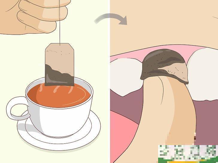 怎么无痛拔牙(怎么无痛拔牙?) 怎么无痛拔牙(怎么无痛拔牙?)