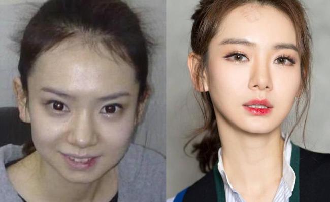 郑爽整容了，郑爽胡彦斌(郑爽胡彦斌照片在干嘛)