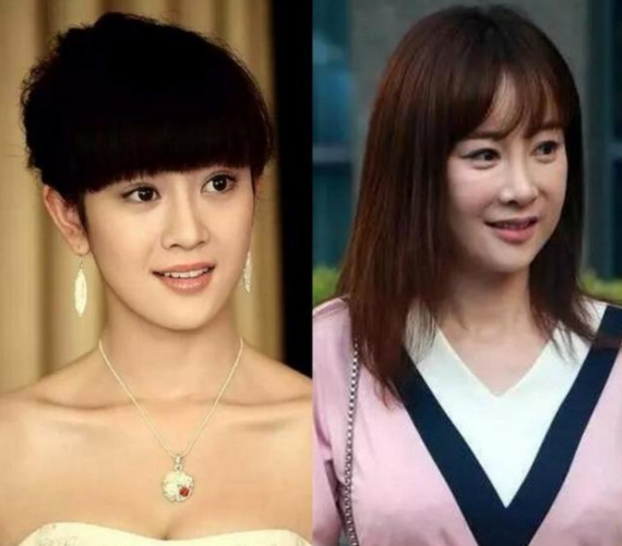 李颖芝整容前，整容失败的二十位明(李梦颖整容)