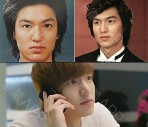 韩国整容失败的明星,韩国整容失败(整容失败韩国人) 韩国整容失败的明星,韩国整容失败(整容失败韩国人)