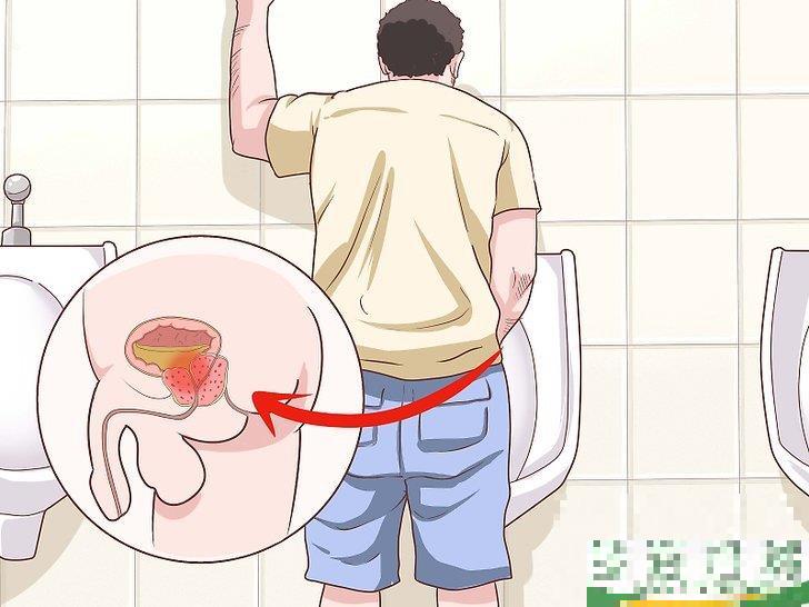 怎么改善前列腺健康(如何缓解前列腺) 怎么改善前列腺健康(如何缓解前列腺)