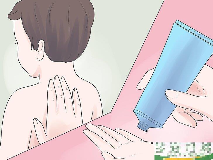 怎么自己在家治疗水痘(水痘在家治疗最佳方法)