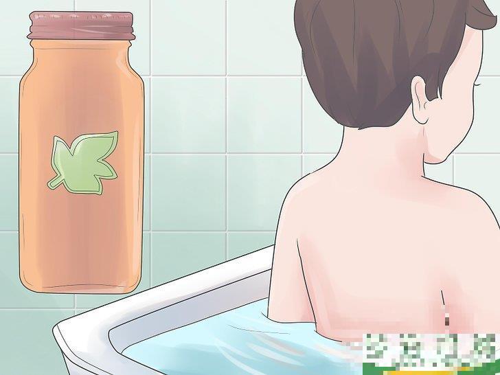 怎么自己在家治疗水痘(水痘在家治疗最佳方法)