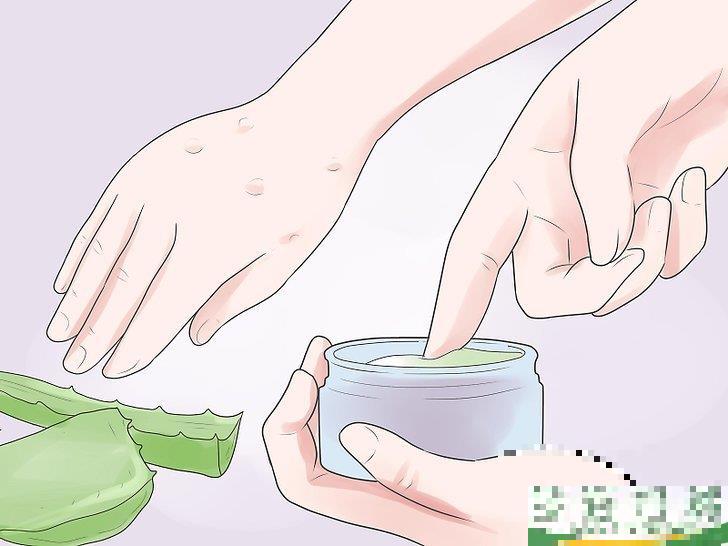 怎么自己在家治疗水痘(水痘在家治疗最佳方法)