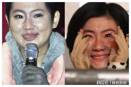 she烧伤，selina俞灏明烧(selina烧伤事件之后为什么从提起俞灏明)