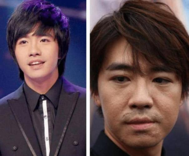 俞灏明烧伤复出图片，俞灏明烧伤恢(俞灏明烧伤是怎么回事)