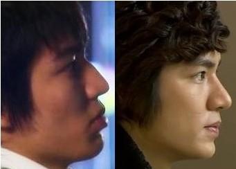 李民浩整容前后,韩佩泉整容前的照(韩佩泉个人经历整容)