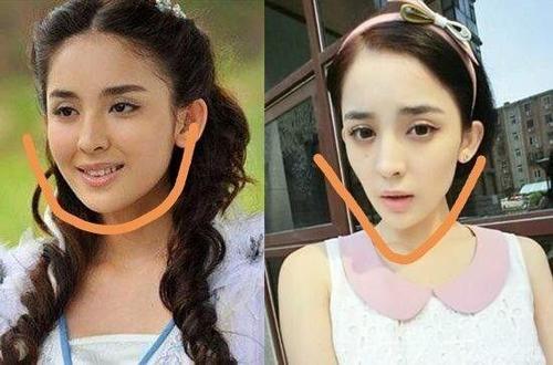 古力娜扎整容,张翰和郑爽(郑爽和古力娜扎怎么回事)