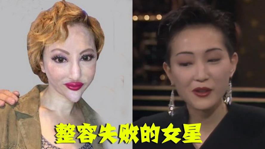 整容失败的女明星,整容失败的10(整容最失败的明星女)