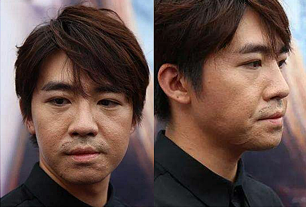 俞灏明烧伤的样子,俞灏明首谈烧伤(烧伤前的俞灏明) 俞灏明烧伤的样子,俞灏明首谈烧伤(烧伤前的俞灏明)