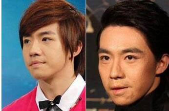 俞灏明烧伤的样子,俞灏明首谈烧伤(烧伤前的俞灏明)