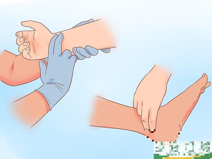 怎么治疗脱位(如何预防假体脱位) 怎么治疗脱位(如何预防假体脱位)