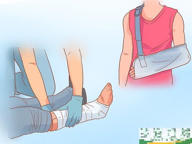 怎么治疗脱位(如何预防假体脱位) 怎么治疗脱位(如何预防假体脱位)