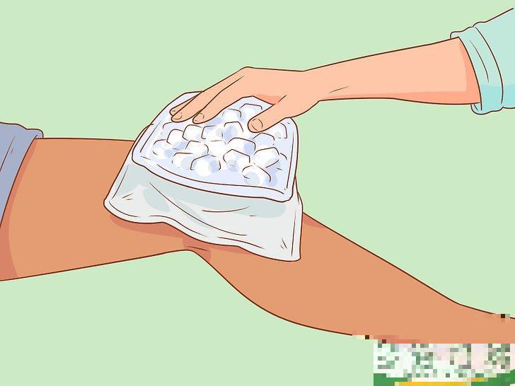 怎么治疗脱位(如何预防假体脱位) 怎么治疗脱位(如何预防假体脱位)