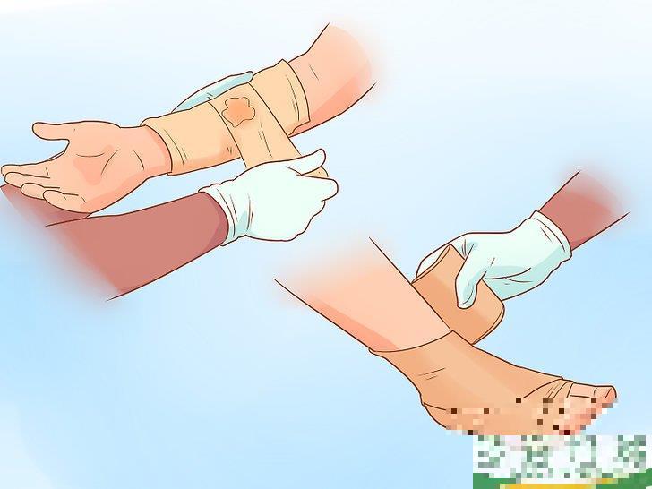 怎么治疗脱位(如何预防假体脱位)