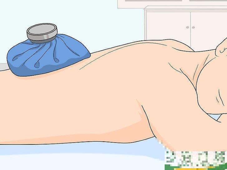 怎么治疗背部拉伤(背上拉伤怎么治疗)