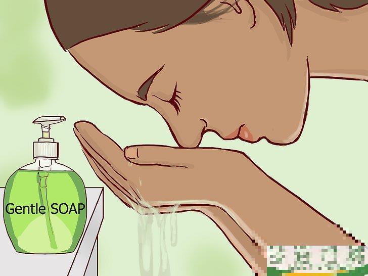 怎么治疗眼部周围的湿疹(眼周皮肤湿疹怎么办) 怎么治疗眼部周围的湿疹(眼周皮肤湿疹怎么办)