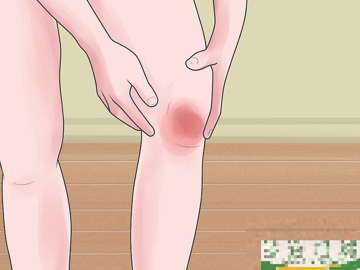 怎么判断自己的膝盖是否拉伤(膝盖拉伤的表现)