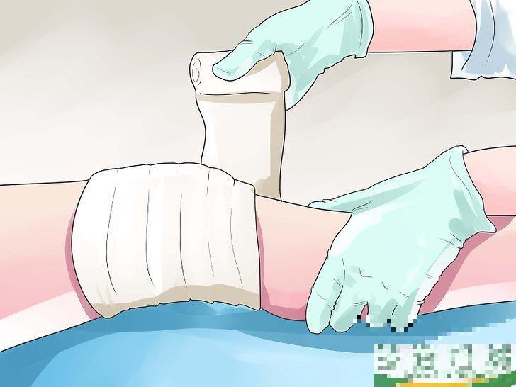 怎么判断自己的膝盖是否拉伤(膝盖拉伤的表现)