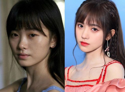 整容前后比较,整形前后效果图(整容手术前后对比照片)