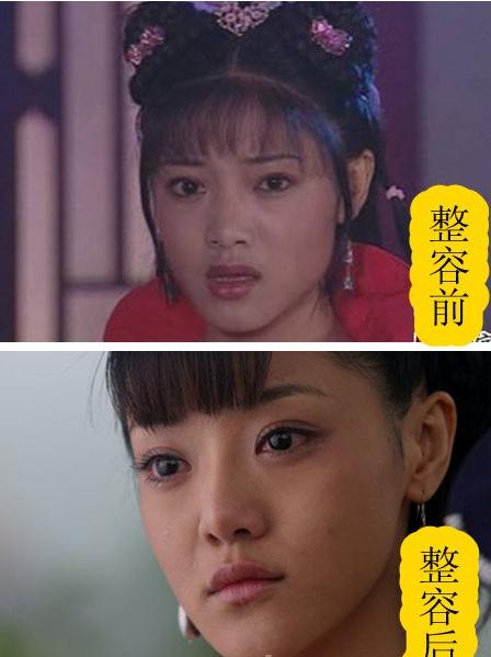 邓家佳整容前后照片,邓家佳年轻时(邓家佳身材) 邓家佳整容前后照片,邓家佳年轻时(邓家佳身材)