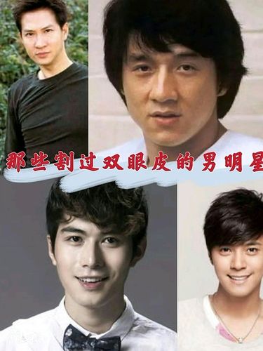 周冬雨割双眼皮了吗,徐娇割双眼皮(周冬雨割的双眼皮是什么形状) 周冬雨割双眼皮了吗,徐娇割双眼皮(周冬雨割的双眼皮是什么形状)