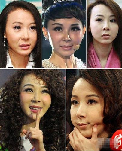 刘雨欣整容前后，许佳琪有没有整容(许佳琪整容过吗)