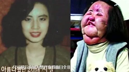 郑爽整容后张翰惊呆 元 郑爽整容后张翰惊呆 元