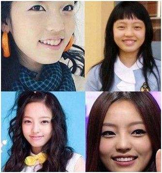 雪莉具荷拉诡异照片(雪莉与具荷拉合照)