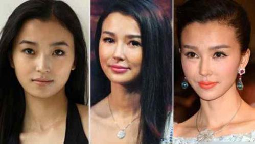 姚星彤整容对比照，姚星彤鼻子图片(姚星彤长相)