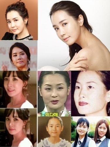 韩国女明星整容,整容很自然的韩国(韩国女明星是不是都整过容)