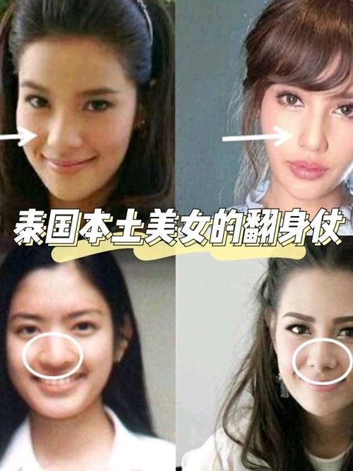 明星整容前后对比照，整形前后对比(明星整容前后的对比)