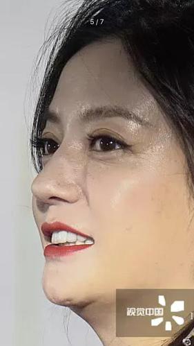 赵薇谈演员整容,演员赵薇的近况(赵薇整容前的照片) 赵薇谈演员整容,演员赵薇的近况(赵薇整容前的照片)