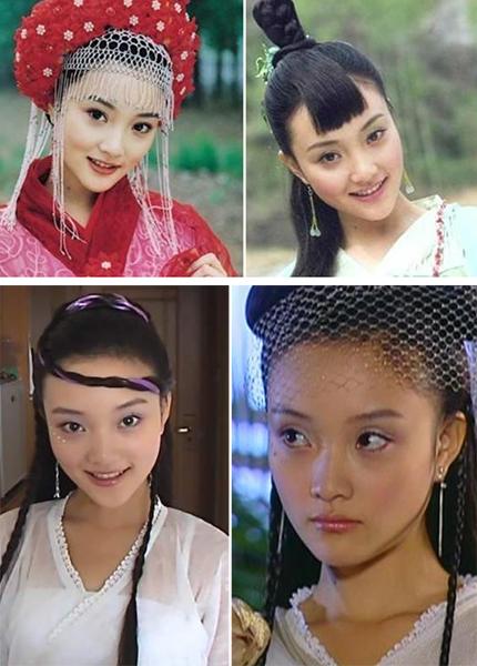 整容失败的女明星，整容失败的10(整容最失败的明星女)