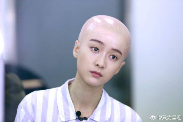 张雪迎为什么剃光头?张雪迎和徐娇撞脸对比(张雪迎长相一般为什么会火) 张雪迎为什么剃光头?张雪迎和徐娇撞脸对比(张雪迎长相一般为什么会火)