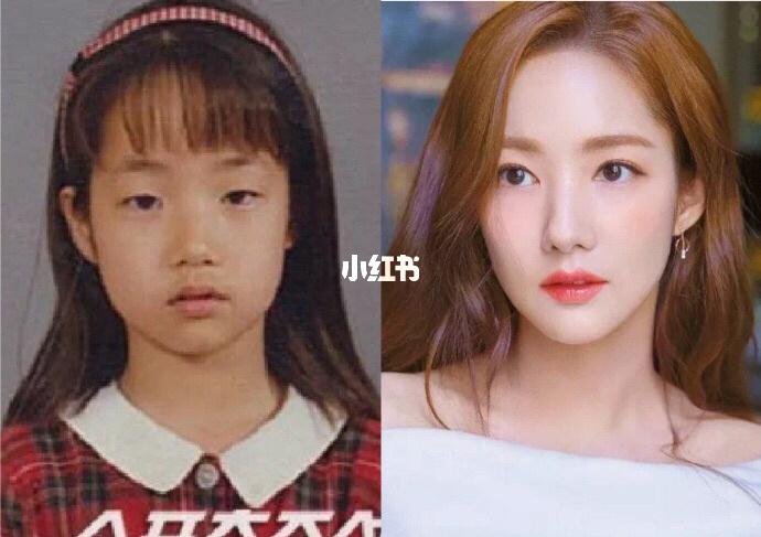 韩国没整容的明星,整容失败的明星(整容失败的韩国女星) 韩国没整容的明星,整容失败的明星(整容失败的韩国女星)