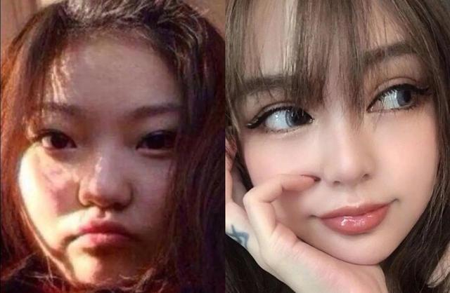 郑爽整容前，上学时关晓彤(关晓彤整容之前)