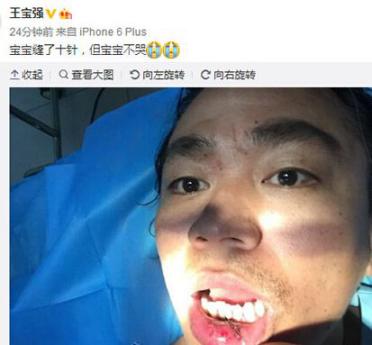吊威亚为什么看不见?吊威亚摔死的明星名单(吊威亚死亡) 吊威亚为什么看不见?吊威亚摔死的明星名单(吊威亚死亡)