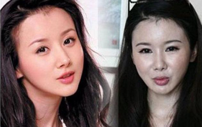 郑爽承认整容，郑爽的粉丝这么忠心(郑爽到底有没有整容呀)